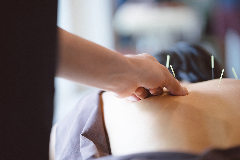 Acupuncturist performing acupuncture